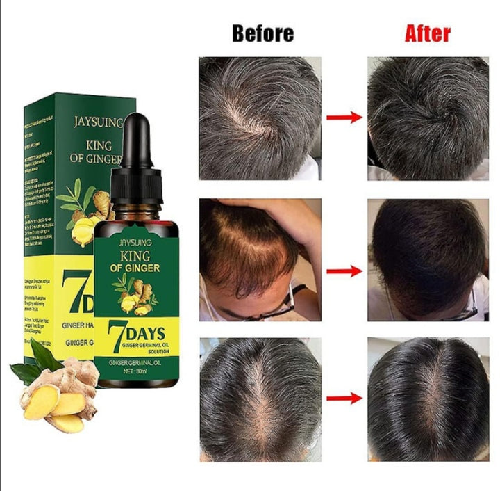 Ulje za kosu serum na bazi djumbira 30ml za rast kose