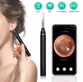 Kamera za uho Otoskop aparat